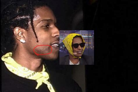 Asap Rocky Scar On Face Asap Rocky Face - Asap Rocky Face Scar Clipart (#1962275) - PikPng